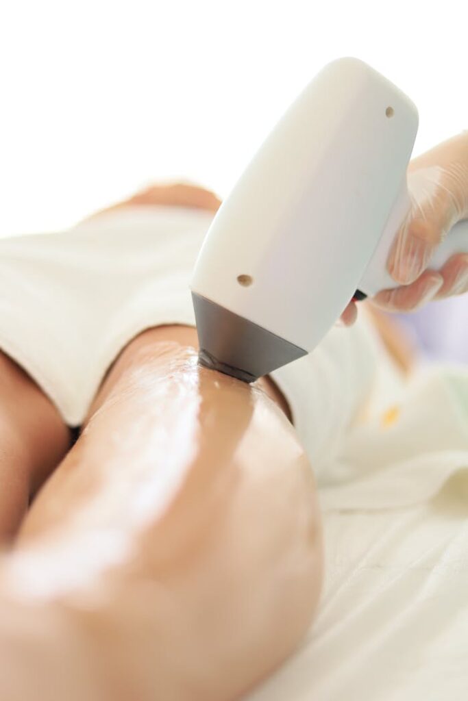 Woman during Laser Hair Removal 
